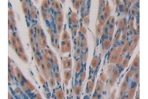 Detection of CYP24A1 in Mouse Stomach Tissue using Polyclonal Antibody to Cytochrome P450 24A1 (CYP24A1) (CYP24A1 Antikörper  (AA 260-514))