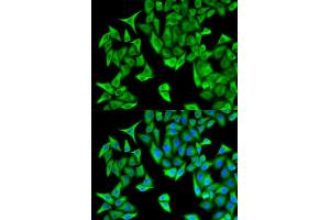 Immunofluorescence analysis of HeLa cells using PSMD9 antibody.