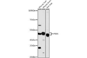 Western blot analysis of extracts of various cell lines, using PRR5 antibody (ABIN7269555) at 1:1000 dilution.