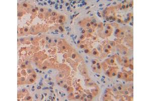 Used in DAB staining on fromalin fixed paraffin- embedded Kidney tissue (MTF1 Antikörper  (AA 2-164))