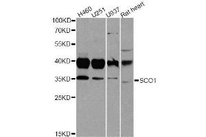 Western blot analysis of extracts of various cell lines, using SCO1 antibody. (SCO1 Antikörper  (AA 1-160))