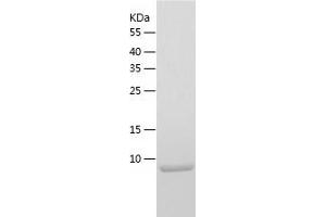 Western Blotting (WB) image for Chemokine (C-C Motif) Ligand 1 (CCL1) (AA 24-96) protein (His tag) (ABIN7285670) (CCL1 Protein (AA 24-96) (His tag))