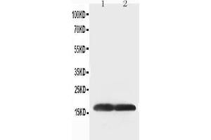 Anti-Superoxide Dismutase 1 antibody, Western blotting Lane 1: COLO320 Cell Lysate Lane 2: SMMC Cell Lysate (SOD1 Antikörper  (C-Term))