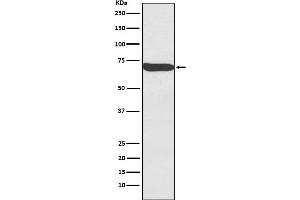 Western blot analysis of Frizzled 9 expression in Human Seminoma lysate.