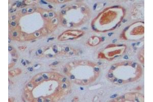 Immunohistochemistry (IHC) image for anti-Coagulation Factor VIII (F8) (AA 2253-2346) antibody (ABIN7434263)