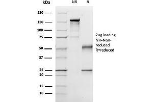 SDS-PAGE Analysis Purified p57 Mouse Monoclonal Antibody (57P06). (CDKN1C Antikörper)