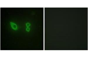 Immunofluorescence analysis of HeLa cells, using Actinin alpha-2/3 Antibody. (ACTN2/3 Antikörper  (AA 31-80))