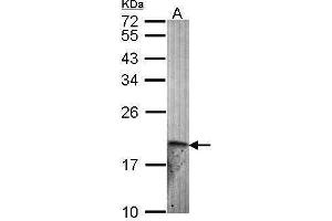 WB Image Sample (30 ug of whole cell lysate) A: Hela 12% SDS PAGE antibody diluted at 1:1000 (Endothelin 2 Antikörper)