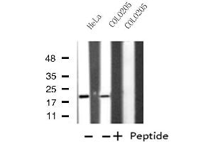 Western blot analysis of extracts from HeLa/COLO205 cells, using MRPL49 antibody. (MRPL49 Antikörper  (Internal Region))