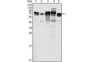Western Blotting (WB) image for anti-Metadherin (MTDH) antibody (ABIN1844342) (MTDH Antikörper)