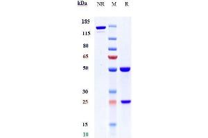 Anti-Complement C2 Reference Antibody (ARGX-117) on SDS-PAGE under reducing (R) condition.
