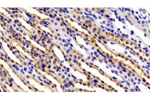 Detection of gp130 in Rat Kidney Tissue using Polyclonal Antibody to Glycoprotein 130 (gp130) (CD130/gp130 Antikörper  (AA 26-323))