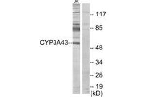 Western blot analysis of extracts from Jurkat cells, using Cytochrome P450 3A43 Antibody. (CYP3A4 Antikörper  (AA 231-280))