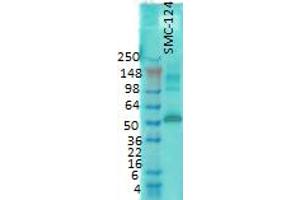 western rat membrane 1 in 1000 CaMKII. (CAMKII gamma Antikörper)