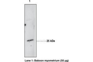 Image no. 1 for anti-Hematopoietic Prostaglandin D Synthase (HPGDS) antibody (ABIN2450695)