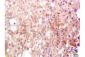 Formalin-fixed and paraffin embedded rat liver tissue labeled Anti-HMGB1 Polyclonal Antibody, Unconjugated (ABIN671616) at 1:400, followed by conjugation to the secondary antibody and DAB staining