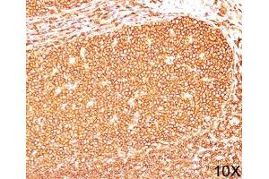 IHC testing of human tonsil (10X) stained with CD45RB antibody (PD7/26). (CD45RB Antikörper)