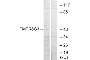 Western Blotting (WB) image for anti-Transmembrane Protease, Serine 3 (TMPRSS3) (C-Term) antibody (ABIN1849485) (TMPRSS3 Antikörper  (C-Term))