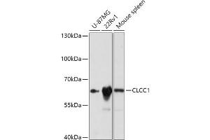 CLCC1 Antikörper  (AA 302-501)