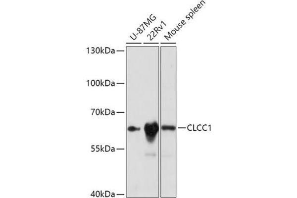 CLCC1 antibody  (AA 302-501)