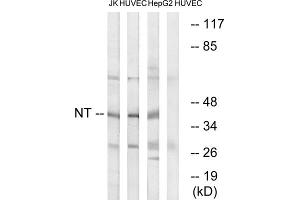 Western blot analysis of extracts from Jurkat cells, HUVEC cells and HepG2 cells, using NT antibody. (NT (C-Term) Antikörper)
