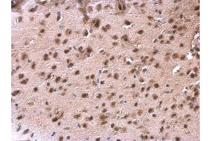 IHC-P Image DDX1 antibody [N3C2], Internal detects DDX1 protein at nucleus on mouse fore brain by immunohistochemical analysis.