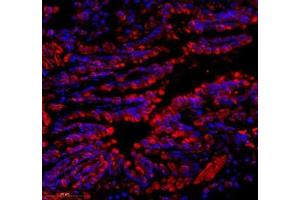 Immunofluorescence of paraffin embedded rat lung using C1orf173 (ABIN7074073) at dilution of 1: 650 (350x lens) (Glutamate-Rich Protein 3 (ERICH3) Antikörper)