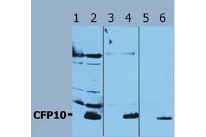 Western Blotting (Mycobacterium Tuberculosis Antigen CFP10 (Rv3874) Antikörper)