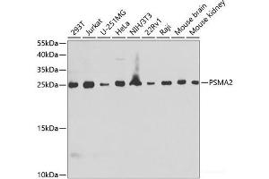 Western blot analysis of extracts of various cell lines using PSMA2 Polyclonal Antibody at dilution of 1:1000. (PSMA2 Antikörper)