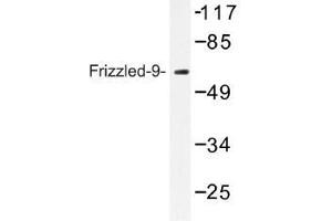 Image no. 1 for anti-Frizzled Family Receptor 9 (FZD9) antibody (ABIN317735) (FZD9 Antikörper)