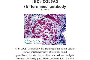 Image no. 1 for anti-Collagen, Type V, alpha 2 (COL5A2) antibody (ABIN1733201)