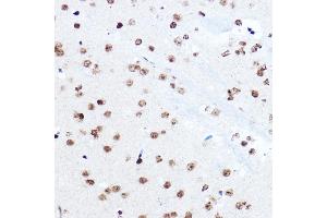 Immunohistochemistry of paraffin-embedded mouse brain using SETD5 Rabbit pAb (ABIN6132960, ABIN6147644, ABIN6147646 and ABIN6223140) at dilution of 1:100 (40x lens). (SETD5 Antikörper  (AA 520-740))