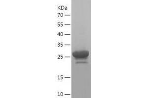 Western Blotting (WB) image for Ionized Calcium-binding Adapter Molecule 1 (IBA1) (AA 93-147) protein (His-IF2DI Tag) (ABIN7121794)