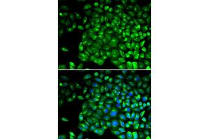 Immunofluorescence analysis of U2OS cells using TNFR2/TNFR2/TNFRSF1B antibody (ABIN1683061, ABIN3015125, ABIN3015126 and ABIN6213832). (TNFRSF1B Antikörper  (AA 30-250))