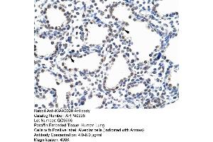 ARP40336 Paraffin Embedded Tissue: Human Lung Cellular Data: Alveolar cells Antibody Concentration: 4. (KIAA0020 Antikörper  (N-Term))