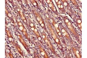 Immunohistochemistry of paraffin-embedded human small intestine tissue using ABIN7175150 at dilution of 1:100 (USHBP1 Antikörper  (AA 1-260))