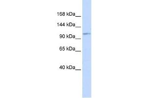 Western Blot showing AVIL antibody used at a concentration of 1-2 ug/ml to detect its target protein. (Advillin Antikörper  (Middle Region))