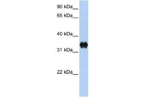 Western Blotting (WB) image for anti-Pyrroline-5-Carboxylate Reductase Family, Member 2 (PYCR2) (C-Term) antibody (ABIN2785963)
