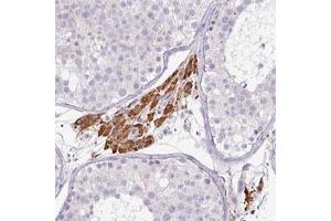 Immunohistochemical staining of human testis shows strong cytoplasmic positivity in Leydig cells. (FGF17 Antikörper)