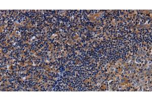 Immunohistochemistry of paraffin-embedded Human tonsil using LIMS1 Polyclonal Antibody at dilution of 1:40