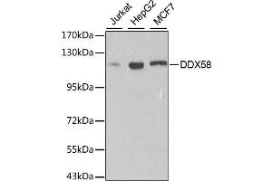 Western blot analysis of extracts of various cell lines, using DDX58 antibody. (DDX58 Antikörper)