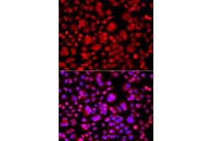 Immunofluorescence analysis of A549 cells using TP53BP2 antibody (ABIN5975391).