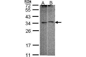 WB Image Sample (30 ug of whole cell lysate) A: 293T B: Raji 12 % SDS PAGE antibody diluted at 1:1000 (FHL5 Antikörper)