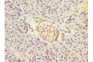 Immunohistochemistry of paraffin-embedded human pancreatic tissue using ABIN7149054 at dilution of 1:100 (CRIP2 Antikörper  (AA 1-208))