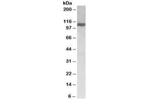 Western blot of Jurkat lysate with KIF5B antibody at 0.