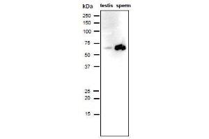 Western Blotting (WB) image for anti-Izumo Sperm-Egg Fusion 1 (IZUMO1) antibody (ABIN2452040)