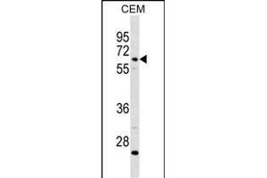 C8B Antibody (C-term) (ABIN1881130 and ABIN2838764) western blot analysis in CEM cell line lysates (35 μg/lane). (C8B Antikörper  (C-Term))