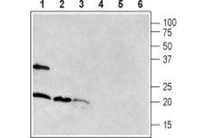 Western blot analysis of rat brain (lanes 1 and 4), mouse brain (lanes 2 and 5) and rat pancreas (lanes 3 and 6): - 1-3. (RAMP1 Antikörper  (Extracellular, N-Term))