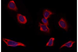 ABIN6264754 and ABIN6273309 staining Hela by IF/ICC. (RIC8B Antikörper  (C-Term))