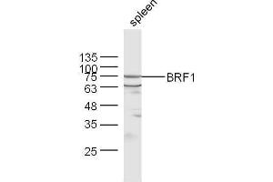Mouse spleen lysates probed with Rabbit Anti-BRF1 Polyclonal Antibody, Unconjugated  at 1:500 for 90 min at 37˚C. (BRF1 Antikörper  (AA 501-600))